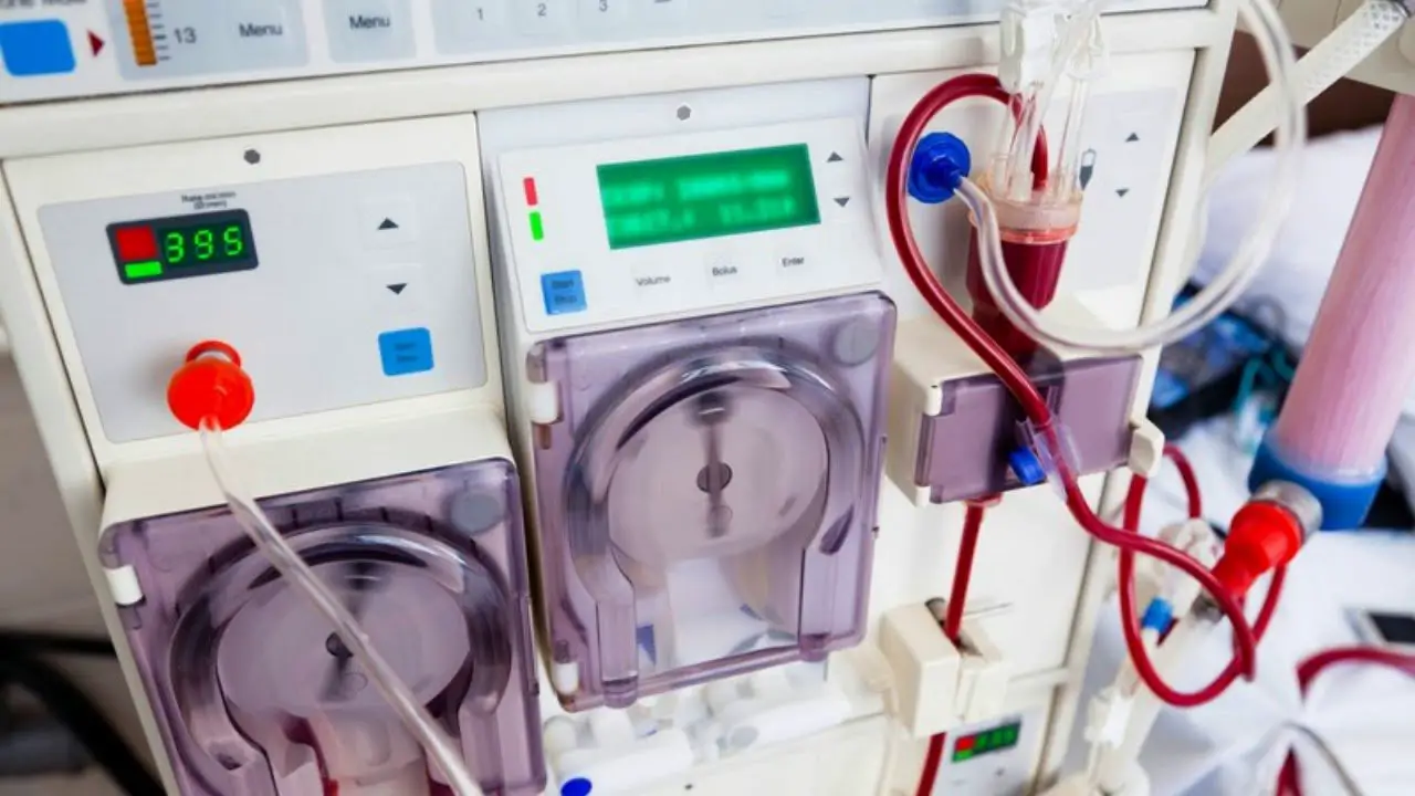 Can You Stop Kidney Dialysis Once You Start